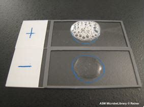 1.18: Catalase Test .